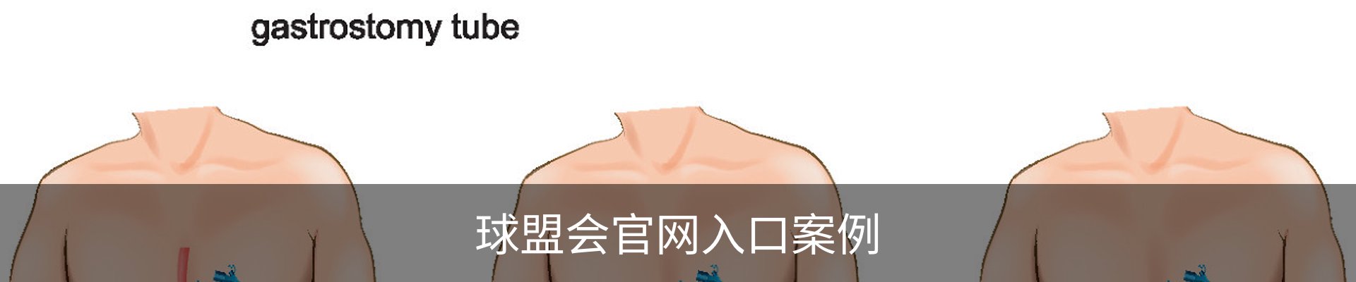 球盟会官网入口案例
